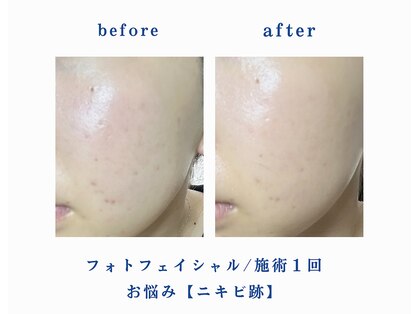 ミセル 尾道店(MYTHEL)の写真