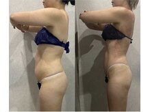 アーネスト(EARNEST)/痩せたい人の痩身エステ