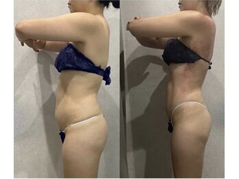 アーネスト(EARNEST)/痩せたい人の痩身エステ