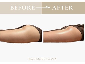 ママリスサロン(Mamariss Salon)/【痩身下半身 1回の施術効果】
