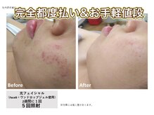 アムール(Amour)