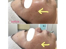 べラマーノ名古屋の雰囲気(ヒト幹細胞で気になるシミケアも★)