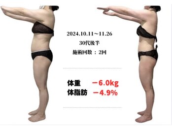 ラヴィ アール(Lavie.R)/痩身/リンパ/リンパマッサージ