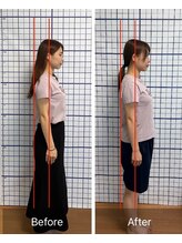 幸鍼灸整体院 武庫之荘院/整体・トレーニング・姿勢変化17