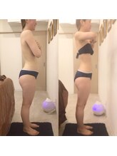 ディア スプリーマ&nbsp;ブライダル エステ