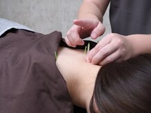 鍼灸院くろえ 大阪江坂