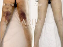 アリリィ(ARILY)/ARILY after care salon