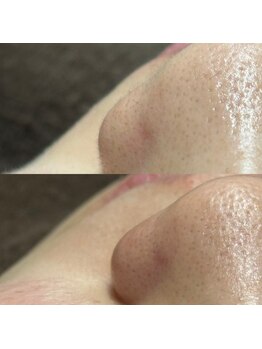 オニュ(onyu)/見た目もキレに★