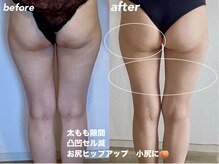 リラクゼーションエステ アジュール(Azur)