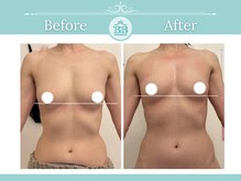 美人バスト 浜松店/◇ バストアップ &nbsp;BeforeAfter◇