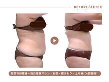 イエス マイサロン(yes My Salon)の雰囲気(【脂肪冷却で徹底痩身】冷やして脂肪細胞ごと減らす最先端技術)