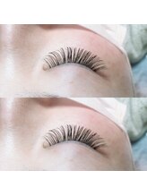 ソレイユ(Soleil)/バインドロック