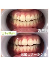 ルブラン 奈良店(Le Blanc)/歯の大掃除お済みですか！！