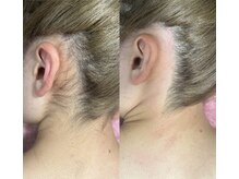 アイラッシュネイルサロン ブリエ(Briller)/うなじWAX脱毛
