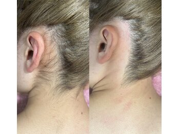 アイラッシュネイルサロン ブリエ(Briller)/うなじWAX脱毛