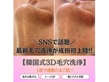 【韓国式3D毛穴洗浄】毛穴トラブル改善◎ちゅるんとたまご肌♪
