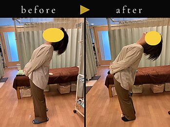 杉本接骨鍼灸院/背骨から全身がユルユル整体