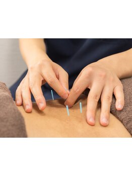 鍼灸施術を受けたい