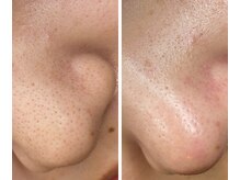 サイ(Sai)/before⇒after