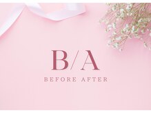 ルナ 千葉(LUNA)/Before After