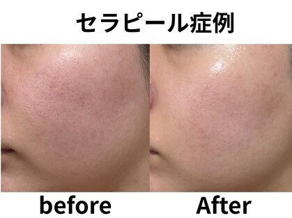 ノエル(Noel)の写真