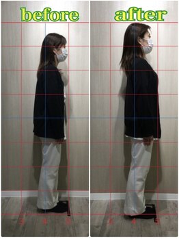 ひつじ整体院 東大宮院/姿勢写真を撮り変化を実感◎