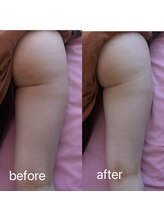 イーリバイブ/iNVYDOM MAX