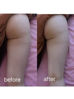 イーリバイブ/iNVYDOM MAX