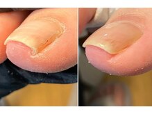 アートラウンジリハナ(Art Lounge Rihana)/フットケア