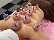 優楽リラクゼーションサロン/２種類のカッピングをご用意☆