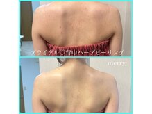 メリー 大和八木店(merry)の雰囲気（★2回目以降も同価格で通いやすいです★大和八木エステ）