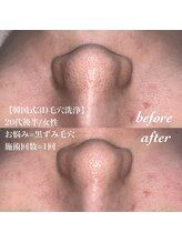 サロン ド カスケード(Salon de Cascade)/韓国式3D毛穴洗浄