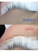 ブーム(BOOM)/エクソソームで細胞からケア