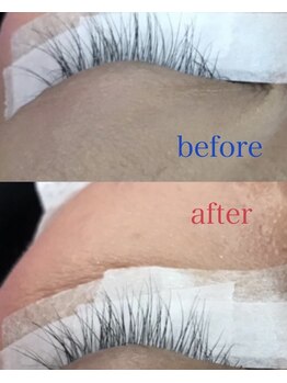 ブーム(BOOM)/エクソソームで細胞からケア