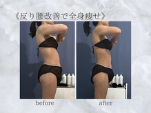 ジュプン 長崎/反り腰改善で全身スッキリ！