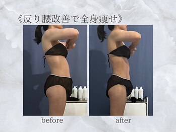 ジュプン 長崎/反り腰改善で全身スッキリ！