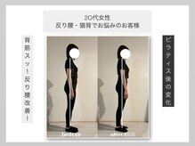 ウィット(Wit.)/猫背・反り腰でお悩みのお客様