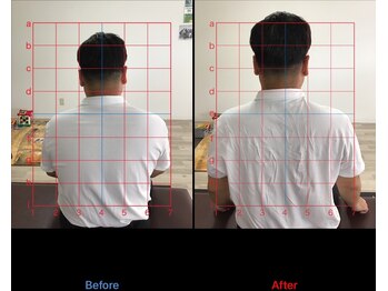 ストレチックス 近江八幡店/ストレッチ ビフォーアフター