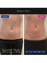 ミモサ 川中島温泉テルメDOME内(mimosa)/