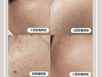 ミランジュ(miranju)の写真