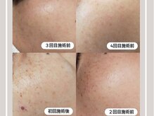 ミランジュ(miranju)