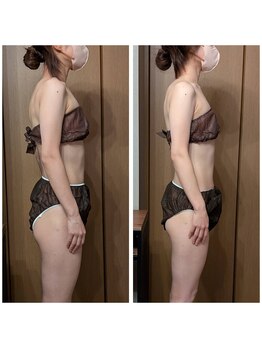 ルマ(Rumah)/猫背・巻き肩改善