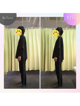 アミーゴ整体院/ビフォーアフター