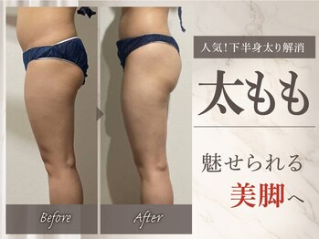 プリオール 前橋南店(Prior)の写真/【下半身太り・脚のむくみに】骨盤矯正×美脚集中ケア!綺麗なラインを目指すサロン☆