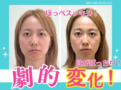 上越かがやき整体院の写真