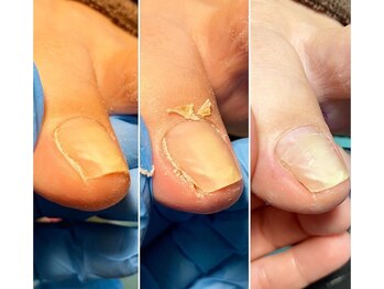 アートラウンジリハナ(Art Lounge Rihana)/フットケア