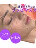 No.2【たるみ改善リフトアップ】バイバイほうれい線たるたるフェイスライン