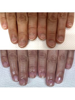 ウェルズユキ(well's yuki)/自爪育成(爪を見られたくない)