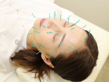 登美ヶ丘治療院の雰囲気（お身体の内面から健康的に美しく、本格的な美容鍼灸です。）