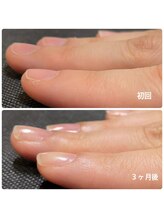 ルームイチマルイチネイルズ(Room101Nails.)/自爪育成・最強のネイルケア鳥取
